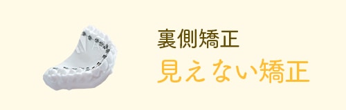 裏側矯正 見えない矯正